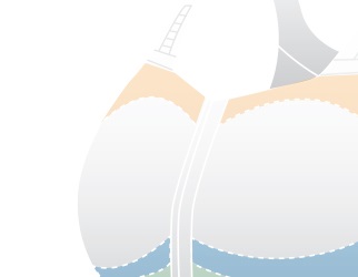 THE IMPORTANCE OF COMPRESSION AND SUPPORT ZONES IN POST-SURGICAL BRAS